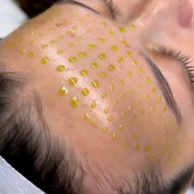 Fresh Peel Pass at FRESH SKIN BY FRANCESCA in Baltimore, MD