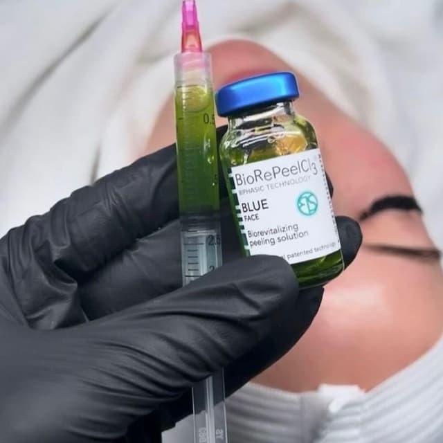 The Peel Perfection Plan at FRESH SKIN BY FRANCESCA in Baltimore, MD